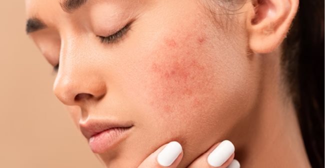 Các lỗi thường gặp khi dùng serum khiến da dễ kích ứng
