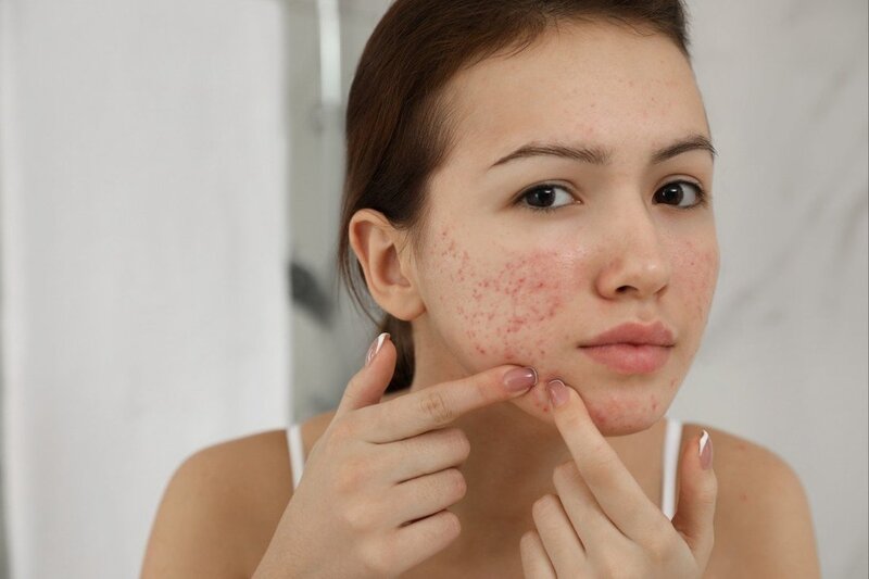Các lỗi thường gặp khi dùng serum khiến da dễ kích ứng