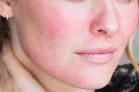 Những sai lầm khi chăm sóc da-moinhat